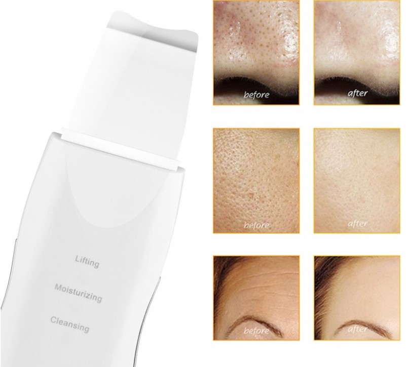 kavitačná špachtľa na čistenie tváre